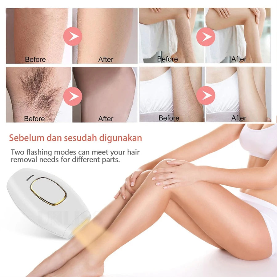Mini IPL Laser Hair Removal