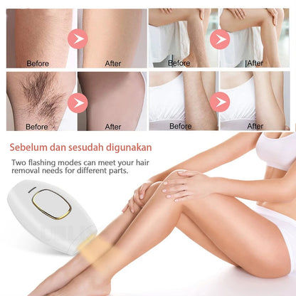Mini IPL Laser Hair Removal